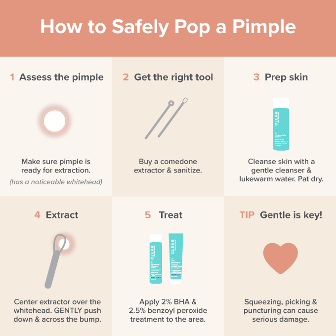 How to Pop a Pimple the Right Way | Paula's Choice
